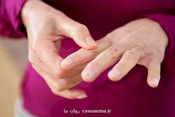 تأثیر داروی درمان آرتریت روماتوئید در جلوگیری از بیماری