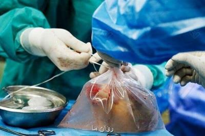اعضای بدن جوان 29 ساله اردبیلی به بیماران نیازمند اهدا شد