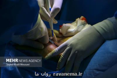 انجام ۱۴ پیوند کلیه و کبد در نخستین روز سال نو
