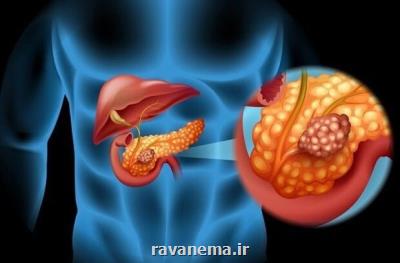 راه های جلوگیری از سرطان را بشناسیم