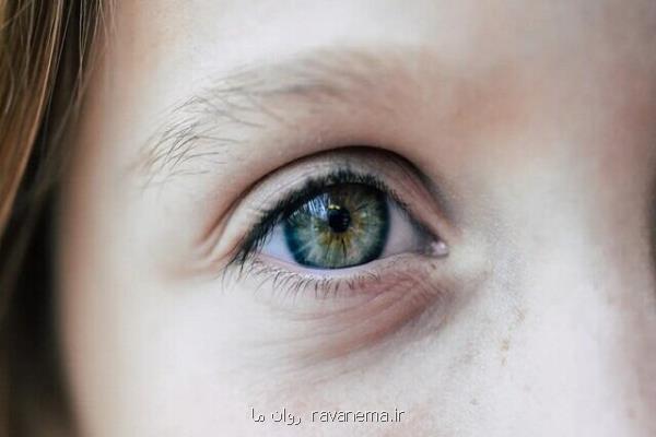 برای مبتلایان به کوررنگی، رنگین کمان هفت رنگ نیست