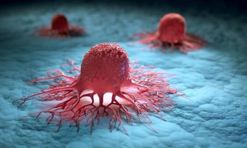 اهمیت تشخیص زودهنگام سرطان ها