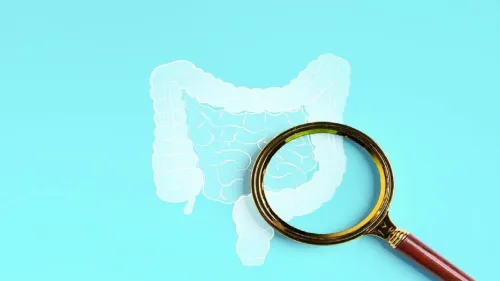 کشف ارتباط بین دارو های کلسترول و کاهش احتمال سرطان روده بزرگ