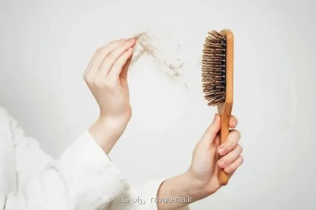 چرا موهای زنان بعد از زایمان می ریزد؟