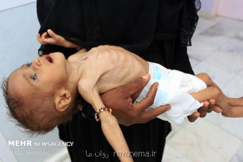 سلامت میلیون ها كودك یمنی در خطر است، طرح شكایت از ائتلاف سعودی